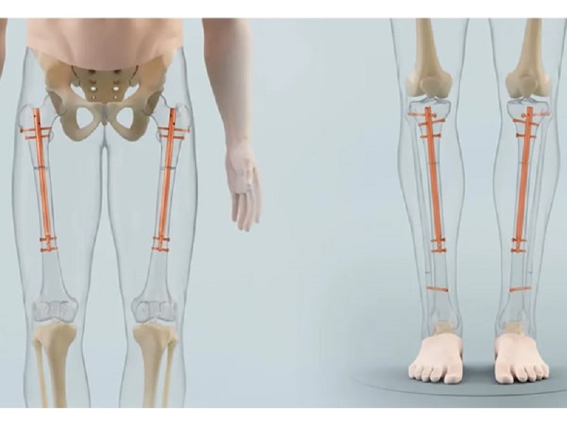 27 tuổi còn tăng chiều cao được không